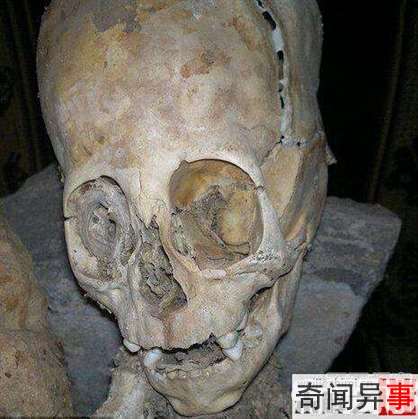 秘鲁神秘巨头干尸或可证外星人存在