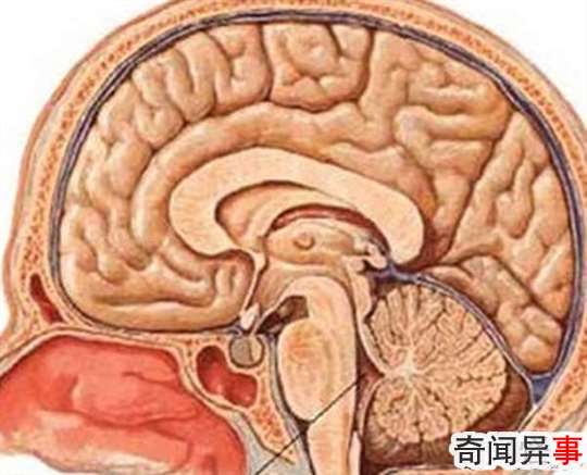 陈百强死亡之谜,昏迷17个月逐渐性脑衰竭离世(服食过量药物)