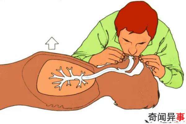 最早采用人工呼吸方法救人的医学家是谁?来自我国古代医圣